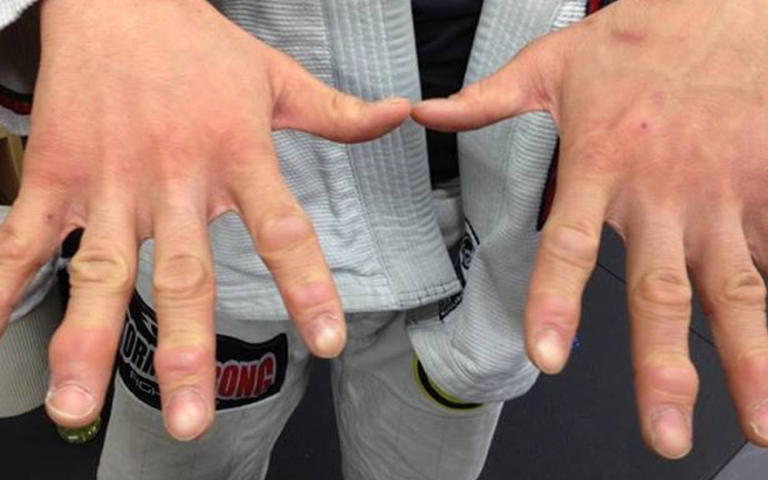 Image of a BJJ practitioner's hands