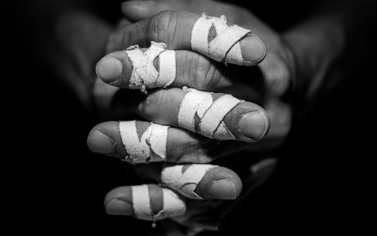 Image of the hands of a BJJ fighter with long nails